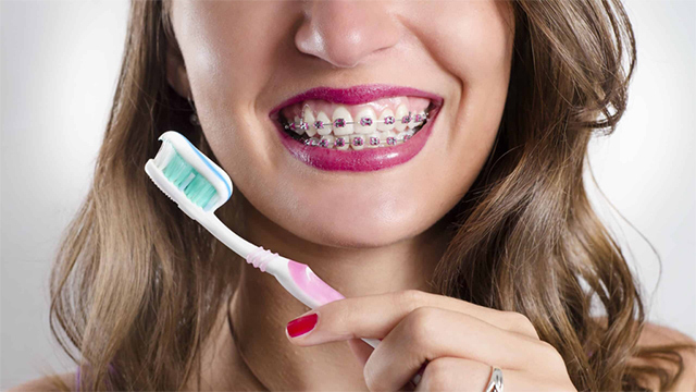 Top 10 kem đánh răng cho người niềng răng tốt nhất 2024