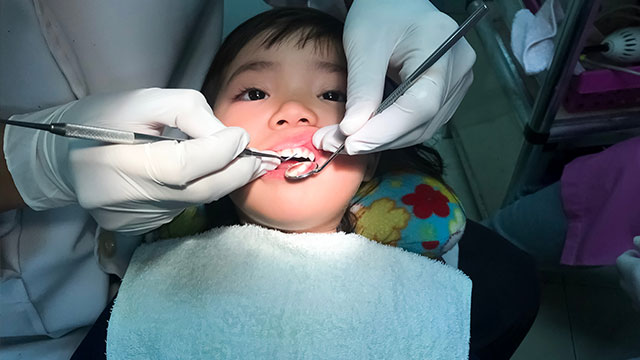 Trám Bít Hố Rãnh Răng: Những Kiến Thức Bạn Cần Biết