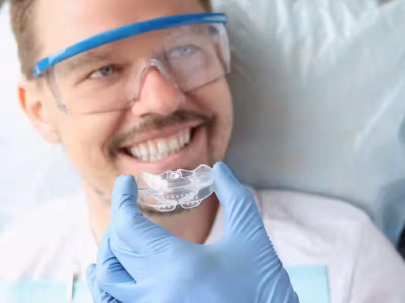 Miếng chống nghiến được thiết kế riêng tại nha khoa cho hiệu quả tốt