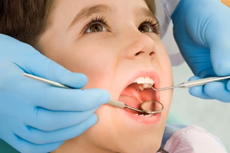 chữa sâu răng cho bé